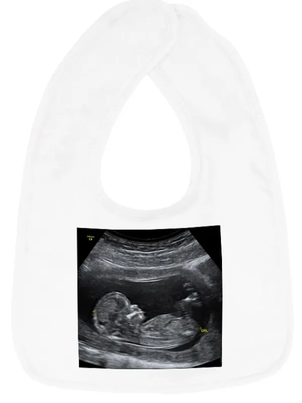 baby_slabbetje_met_foto___2.webp Hospitrix Baby Slabbetje met Foto / Logo